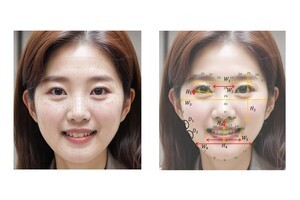  LG생활건강, 비전AI 기술로 얼굴 부위별 노화 시계 비밀 밝혀